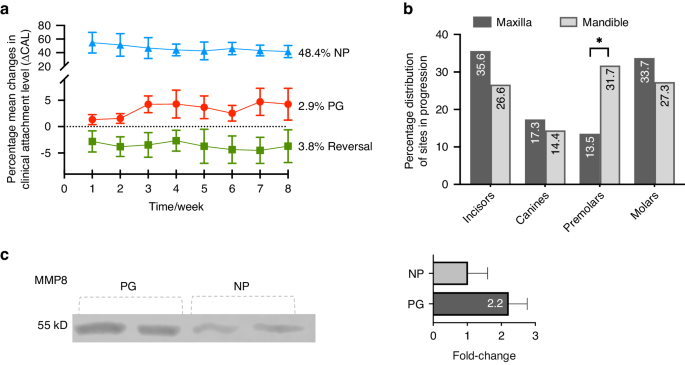 A multi-platform analysis of human gingival crevicular fluid reveals ferroptosis as a relevant regulated cell death mechanism during the clinical progression of periodontitis