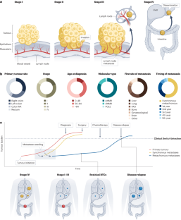 Mechanisms of metastatic colorectal cancer