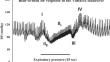 Physiological Targets for Orthostatic Hypotension: Improving Nonpharmacological Interventions in Patients with Orthostatic Cerebral Hypoperfusion