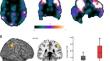 Long-term effects of childhood single-parent family structure on brain connectivity and psychological well-being.