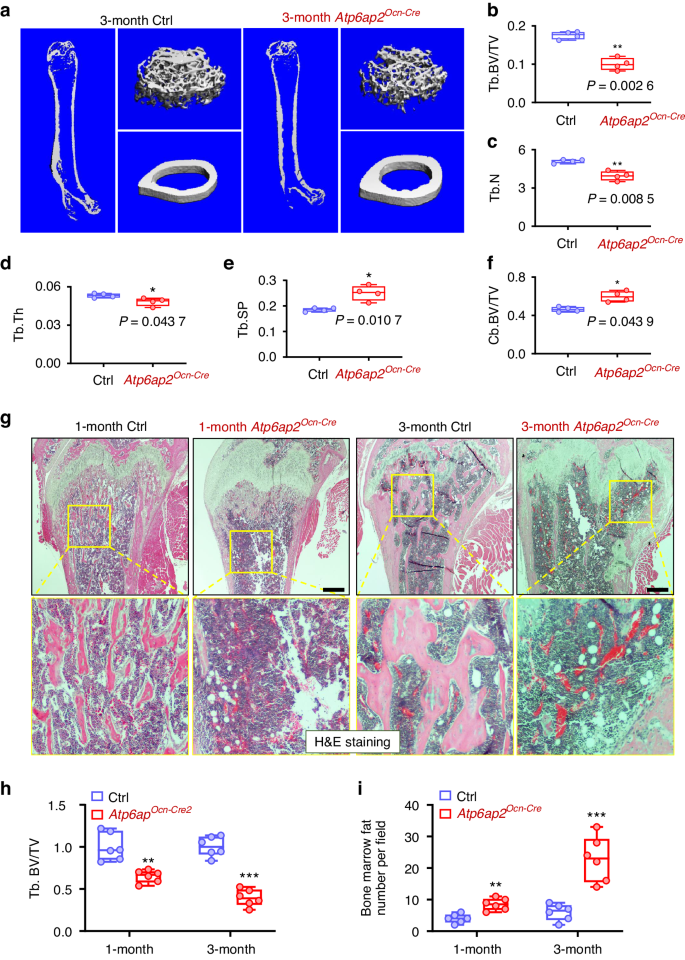 ATP6AP2, a regulator of LRP6/β-catenin protein trafficking, promotes Wnt/β-catenin signaling and bone formation in a cell type dependent manner