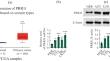 Knockdown of PRR11 Induces Autophagy in Glioma Cells by Inhibiting Akt/mTOR Signaling Pathway