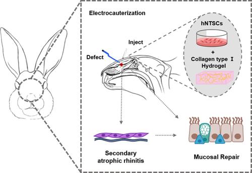 Tissue specific stem cell therapy for airway regeneration