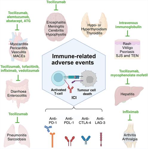 Treatment options for immune-related adverse events associated with immune checkpoint inhibitors.