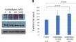 Azelnidipine protects HL-1 cardiomyocytes from hypoxia/reoxygenation injury by enhancement of NO production independently of effects on gene expression.