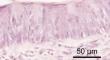 The existence of cells exhibiting characteristics of both Type II and Type III cells in rat taste buds. An immunohistochemical and electron-microscopic study.