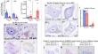 Alternatively spliced ELAVL3 cryptic exon 4a causes ELAVL3 downregulation in ALS TDP-43 proteinopathy.