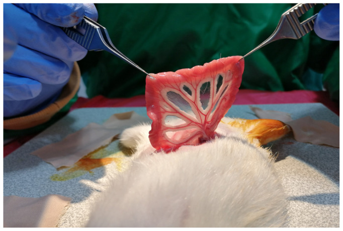 Effect of vascularized jejunal conduit flap on peripheral nerve regeneration in rats.