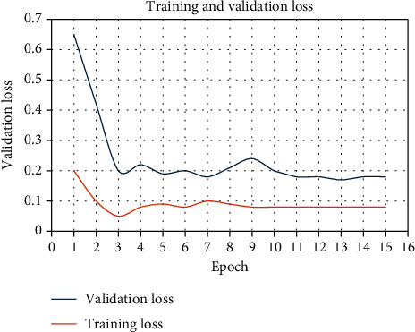 COVID-19 Detection from Computed Tomography Images Using Slice Processing Techniques and a Modified Xception Classifier.