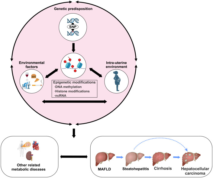 MAFLD: an ideal framework for understanding disease phenotype in individuals of normal weight.
