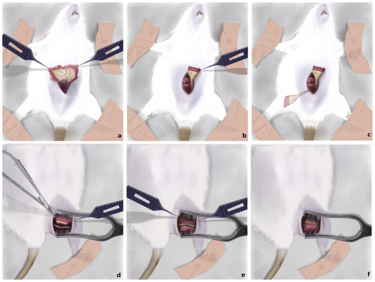 Effect of vascularized jejunal conduit flap on peripheral nerve regeneration in rats.