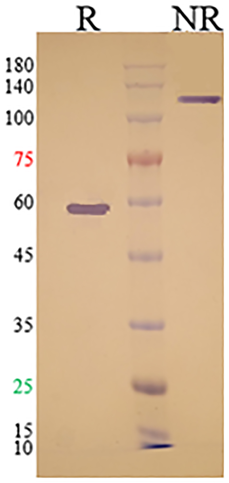 Preclinical assessment of a recombinant RBD-Fc fusion protein as SARS-CoV-2 candidate vaccine.