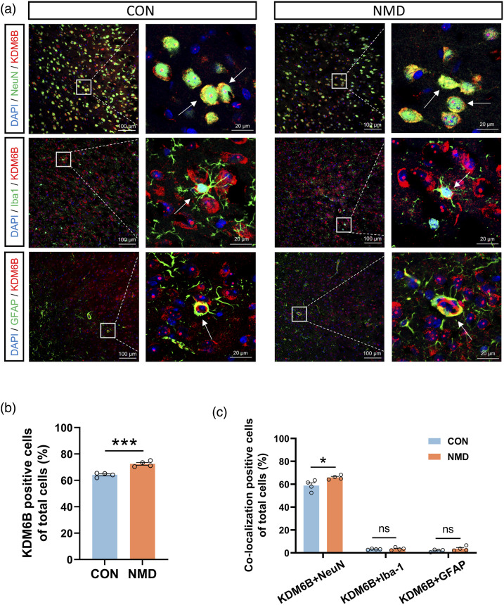 Upregulation of KDM6B in the anterior cingulate cortex contributes to neonatal maternal deprivation-induced chronic visceral pain in mice.