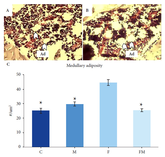 Metformin treatment prevents experimental metabolic syndrome-induced femoral bone marrow adiposity in rats.