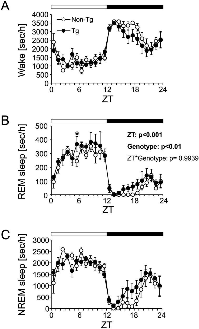Circadian and sleep phenotypes in a mouse model of Alzheimer's disease characterized by intracellular accumulation of amyloid β oligomers.