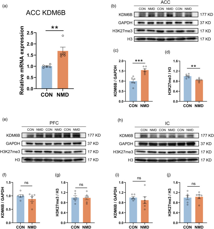 Upregulation of KDM6B in the anterior cingulate cortex contributes to neonatal maternal deprivation-induced chronic visceral pain in mice.