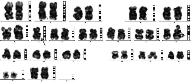 Endosulfan induces reproductive & genotoxic effect in male and female Swiss albino mice.