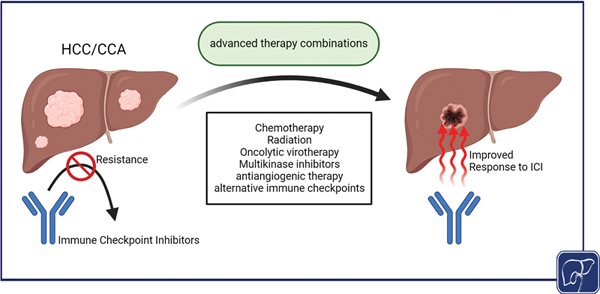 Overcoming Resistance to Immune Checkpoint Blockade in Liver Cancer with Combination Therapy: Stronger Together?