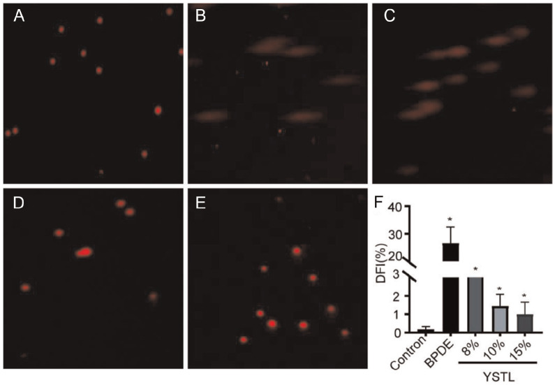 Exploring the Mechanisms of Yishen Tongluo Decoction on Repairing DNA Damage in Mouse Spermatogonia Cells Based on Whole Transcriptome Sequencing.