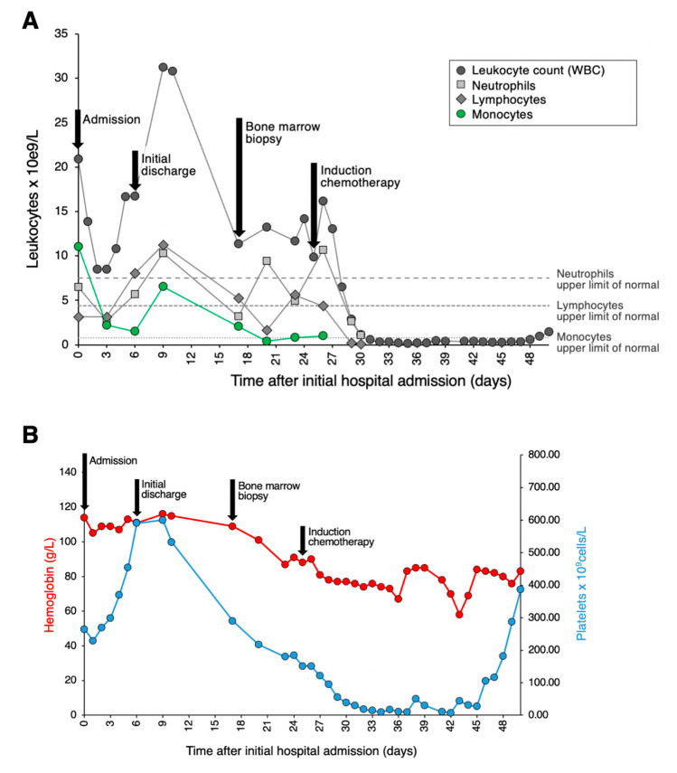 Morphological Clues of Acute Monocytic Leukemia in COVID-19-Induced Transient Leukoerythroblastic Reaction with Monocytosis.