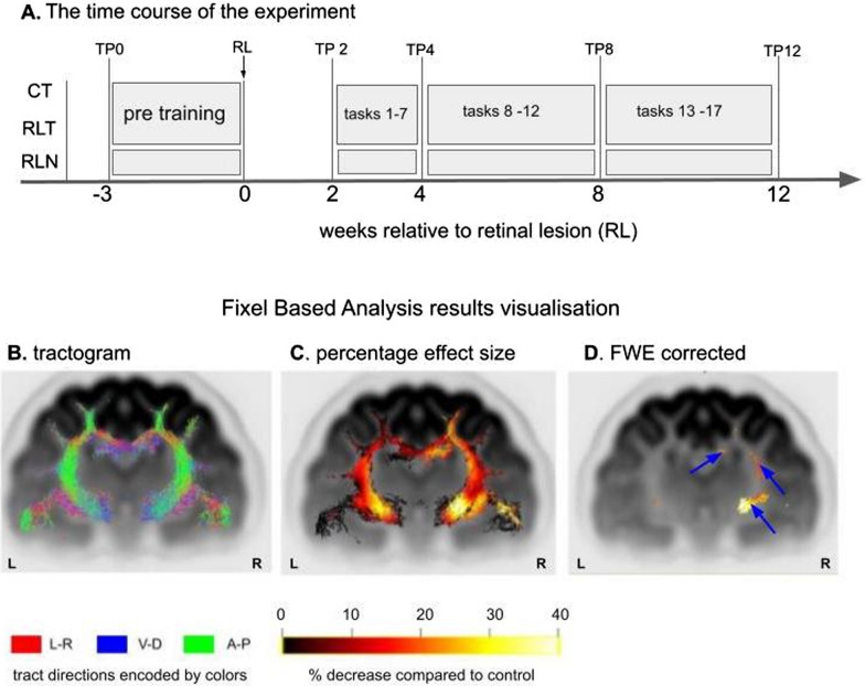 Visual training after central retinal loss limits structural white matter degradation: an MRI study.