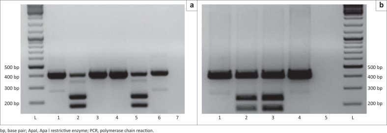 Maternally inherited diabetes and deafness with a variable presentation across three generations within a pedigree, South Africa.