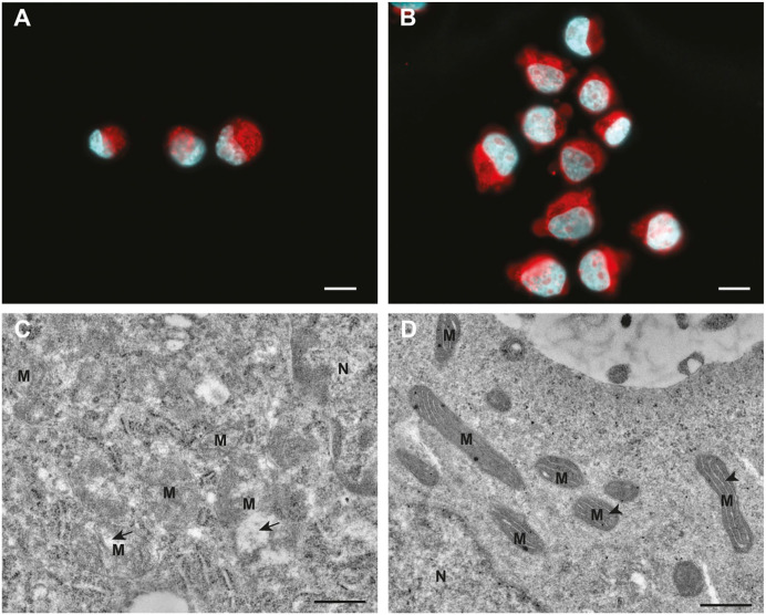 New Insights in ATP Synthesis as Therapeutic Target in Cancer and Angiogenic Ocular Diseases.