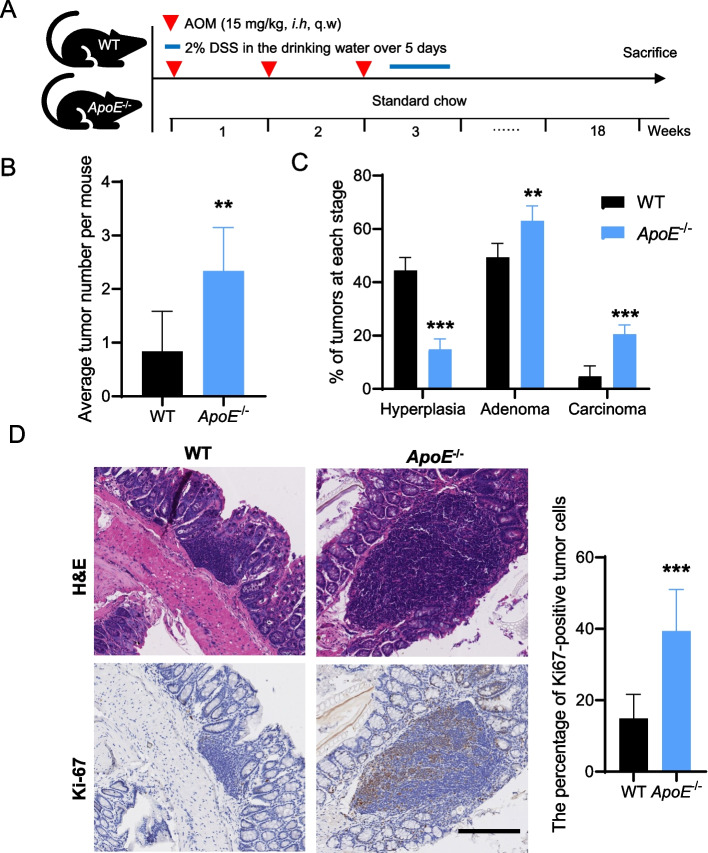 Hypoxia-induced NOS1 as a therapeutic target in hypercholesterolemia-related colorectal cancer.