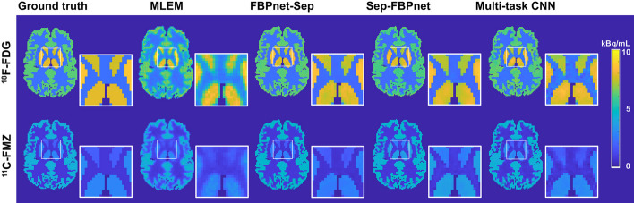 Signal separation of simultaneous dual-tracer PET imaging based on global spatial information and channel attention.
