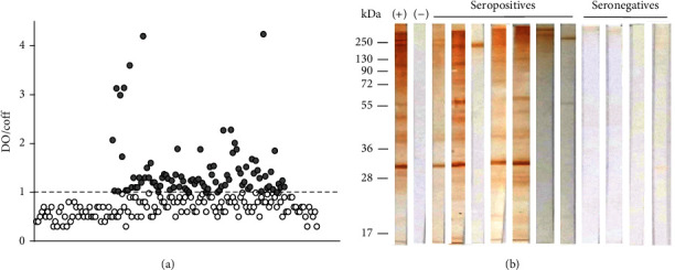 First Report of Seropositivity to <i>Trypanosoma cruzi</i> in Mexican Afro-Descendants from Guerrero and Oaxaca States.