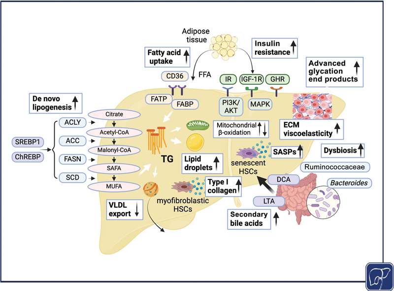Molecular Genealogy of Metabolic-associated Hepatocellular Carcinoma.