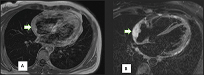 Unusual Finding in a Patient Presenting with Abdominal Pain and Dyspnea.