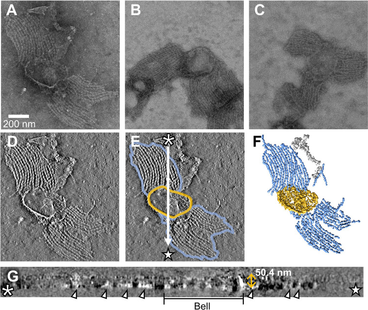Internal structure of <i>Mycoplasma mobile</i> gliding machinery analyzed by negative staining electron tomography.