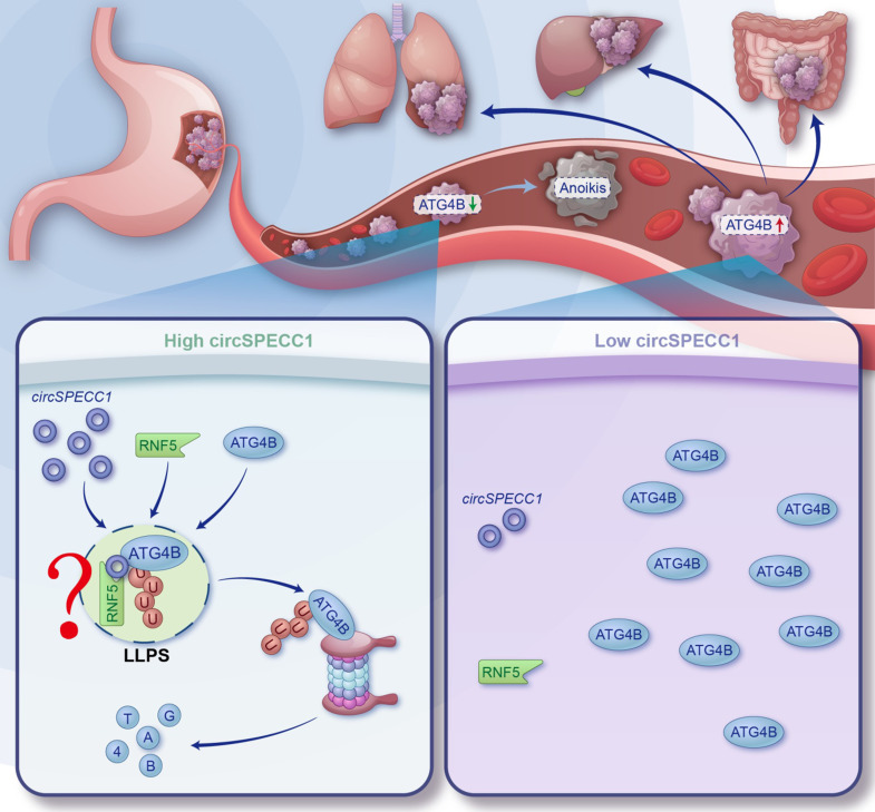 CircRNA regulates the liquid-liquid phase separation of ATG4B, a novel strategy to inhibit cancer metastasis?
