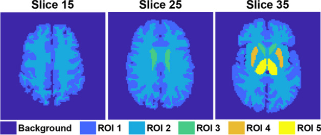 Signal separation of simultaneous dual-tracer PET imaging based on global spatial information and channel attention.