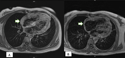 Unusual Finding in a Patient Presenting with Abdominal Pain and Dyspnea.