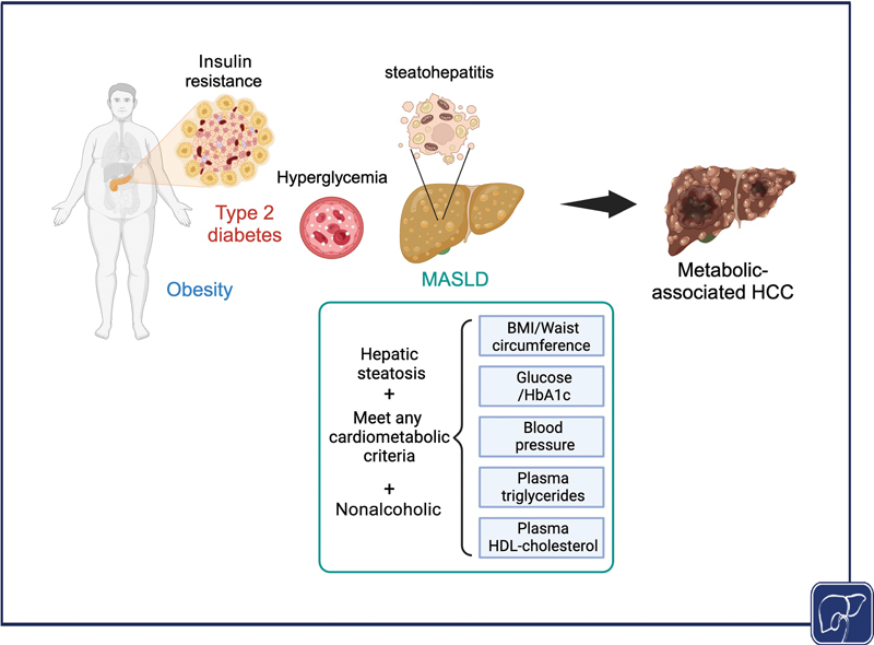 Molecular Genealogy of Metabolic-associated Hepatocellular Carcinoma.