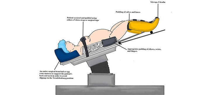 Clinical Considerations and Outcomes of Robotic Urologic Surgery in Obese Patients.