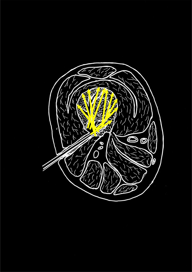 Management of open fracture and related complications: the Japanese way.