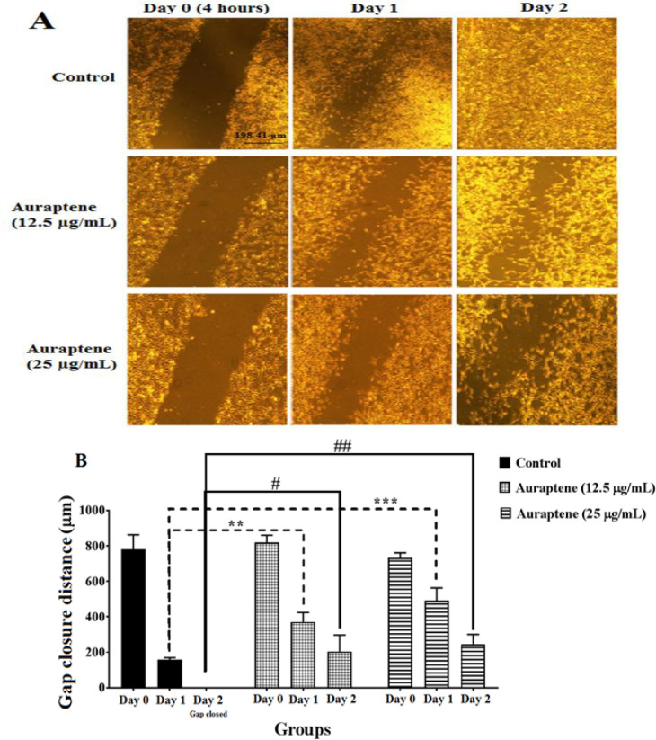 Auraptene inhibits migration, invasion and metastatic behavior of human malignant glioblastoma cells: An <i>in vitro</i> and <i>in silico</i> study.