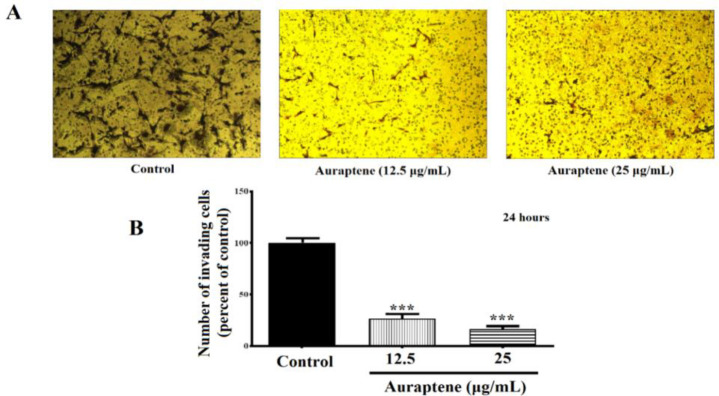 Auraptene inhibits migration, invasion and metastatic behavior of human malignant glioblastoma cells: An <i>in vitro</i> and <i>in silico</i> study.