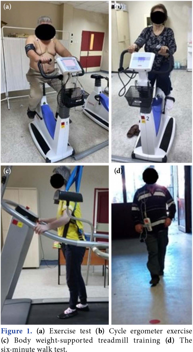Which aerobic exercise is more effective in Parkinson's patients? Cycle ergometer versus body weight-supported treadmill.