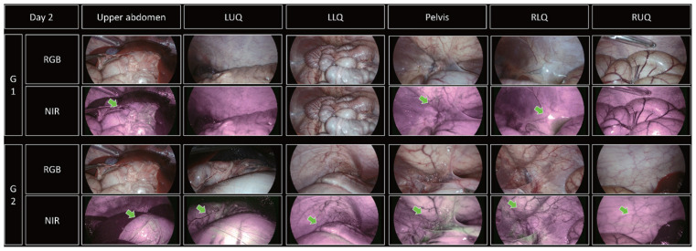 Prediction of the minimum amount of anti-adhesive agent required for entire intra-abdominal cavity using fluorescent dye.