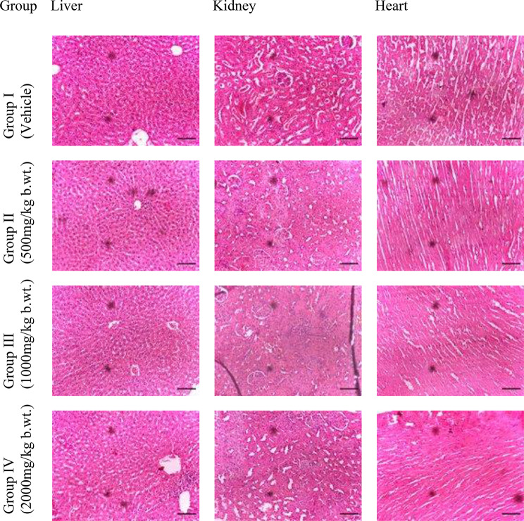 Towards a natural treatment for mania: red onion husk extract modulates neuronal resilience, redox signalling, and glial activation.