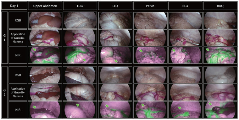 Prediction of the minimum amount of anti-adhesive agent required for entire intra-abdominal cavity using fluorescent dye.