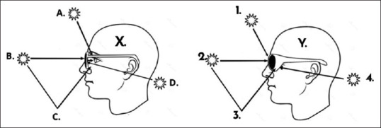 Myopia intervention and ultraviolet radiation related eye diseases: A narrative literature review.