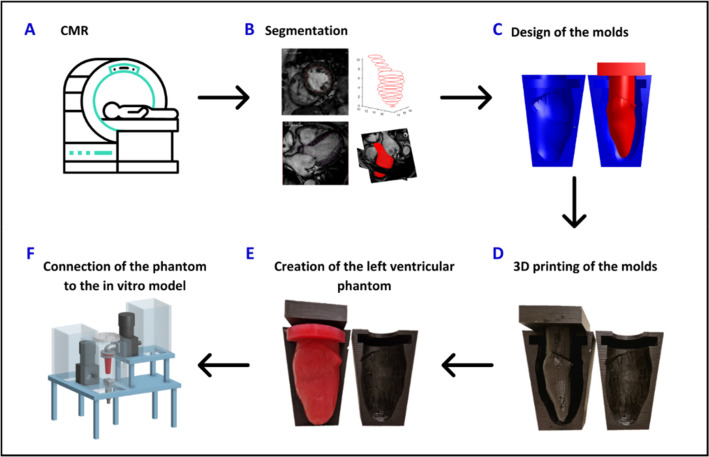 A patient-specific echogenic soft robotic left ventricle embedded into a closed-loop cardiovascular simulator for advanced device testing.