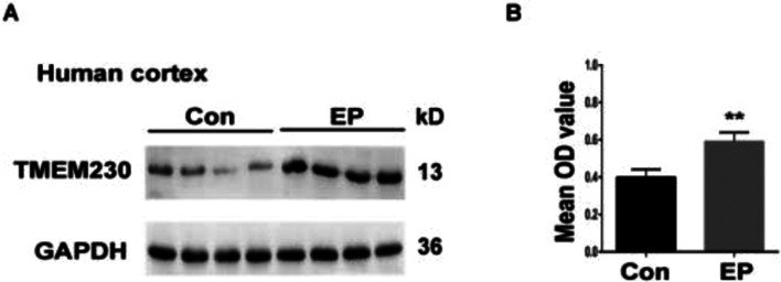 Transmembrane protein modulates seizure in epilepsy: evidence from temporal lobe epilepsy patients and mouse models.