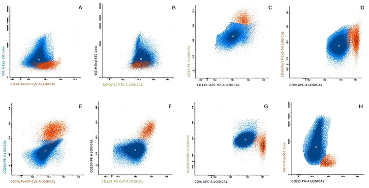 Acute Promyelocytic Leukemia with Basophilic Differentiation: A Rare Variant