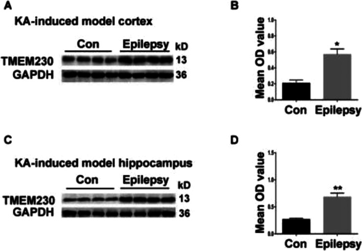 Transmembrane protein modulates seizure in epilepsy: evidence from temporal lobe epilepsy patients and mouse models.